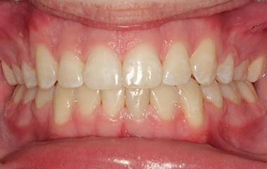 Williams - After Braces Results | Tripp Leitner Orthodontics